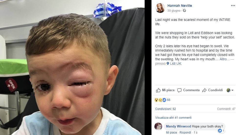 pacchetto noccioline