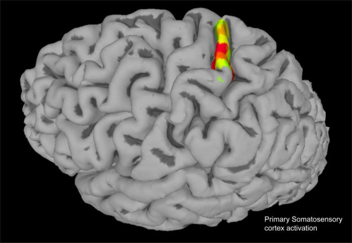 Tumori, scoperto il meccanismo che provoca le metastasi al cervello