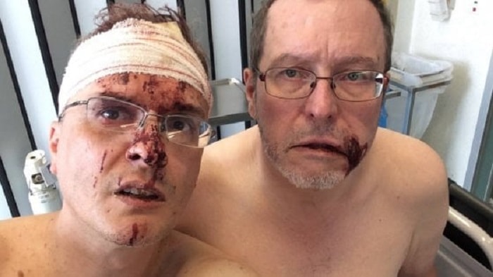 Mauro Padovani e suo marito Tom Freeman, aggressione omofoba in Belgio: sprangate dai vicini