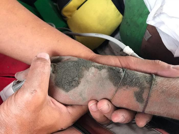 Carmen Tammaro e Antonio Santopaolo, genitori eroi: hanno salvato figlie coi corpi. Chiara, mano simbolo