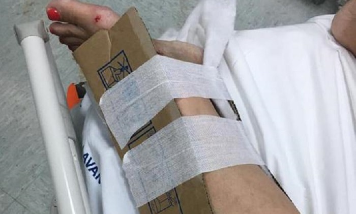 Ospedale Reggio Calabria ingessa col cartone! Ma non era vero. Era una fake...ufficiale