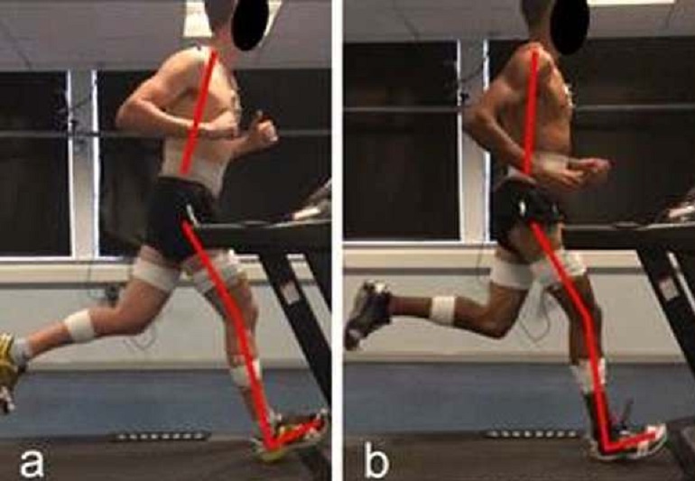 Corsa, come correre correttamente per evitare problemi alla schiena e alle articolazioni