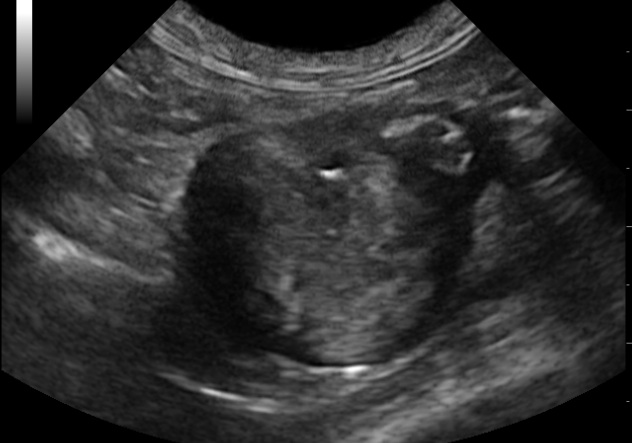 dolori stomaco tartaruga vagina