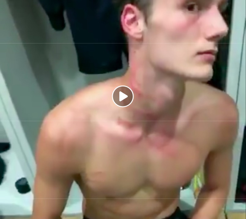 Rudiger stampa i tacchetti sul collo di Pavard, poi si scusa: "Non era intenzionale..."