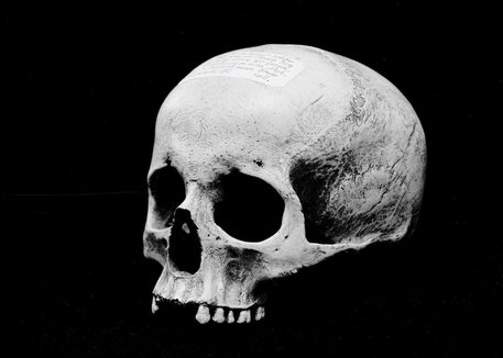 Teschi per corrispondenza: nei pacchi postali Ups terza scatola cranica in partenza da Milano