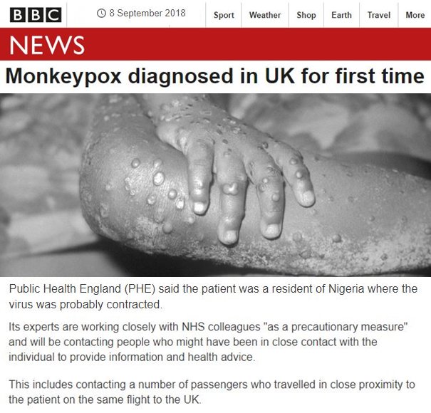 Vaiolo delle scimmie, secondo caso in Gran Bretagna