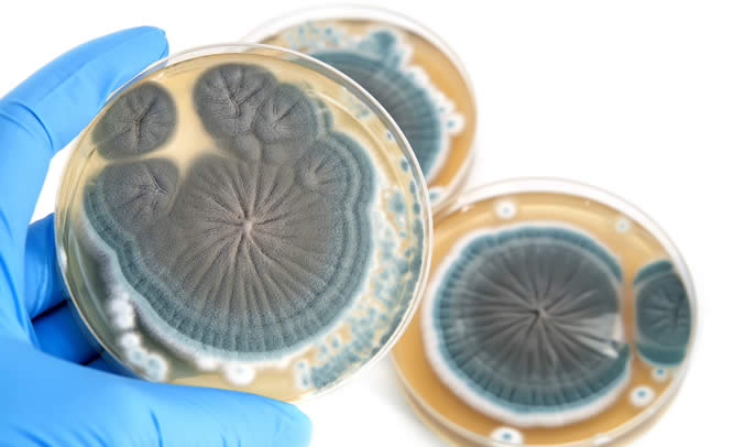 Penicillina, 1 su 10 è convinto di essere allergico. Ma gli antibiotici ad ampio spettro sono più pericolosi