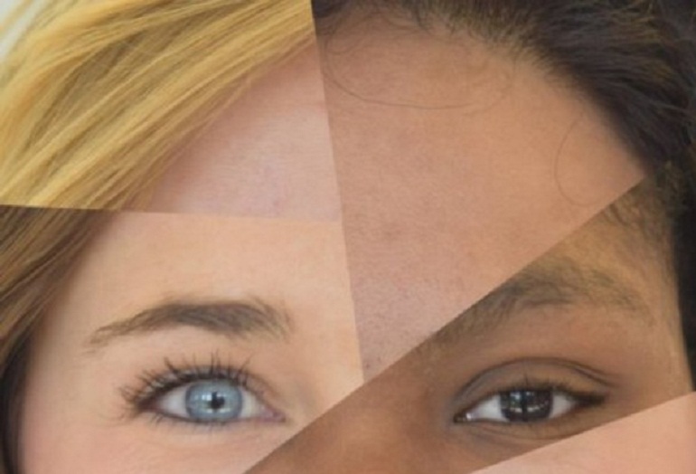 Nina Ajdin, dipendente dalle creme steroidee: perde capelli e sviluppa problemi alla pelle (foto d'archivio Ansa)