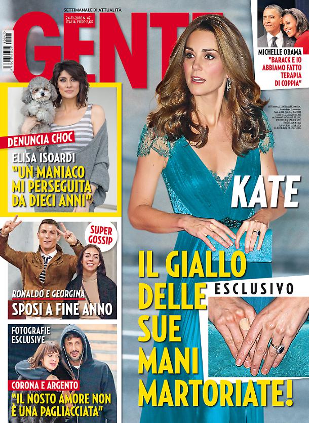 kate middleton psoriasi