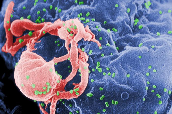 Aids, vaccino per bambini con Hiv: sperimentazione al via in Italia, Thailandia e Sudafrica