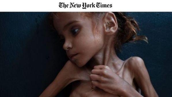 Amal, morta di fame a 7 anni in Yemen: di lei ci resta una sola foto
