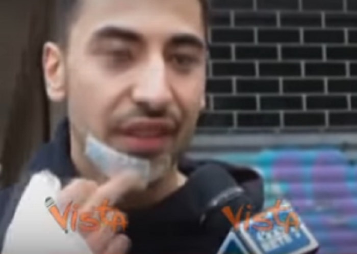 Bologna picchiato a sangue