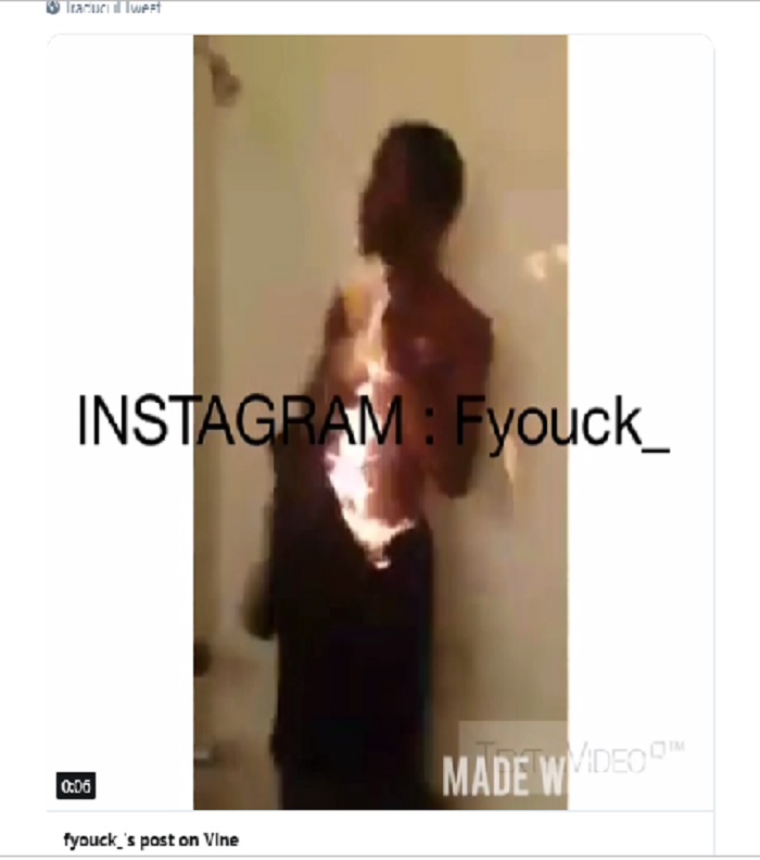 Fire Challange: la nuova rischiosa sfida sui social, teenagers ustionati a vita e ricoverati in ospedale IL VIDEO