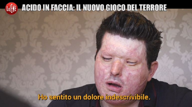 Acido in faccia, il servizio de Le Iene: "In Gb casi aumentati del 940% in sei anni"