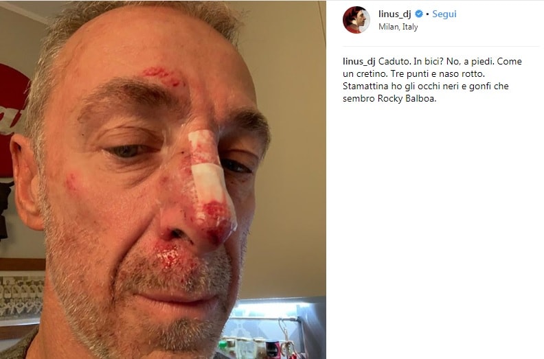 Linus col volto tumefatto