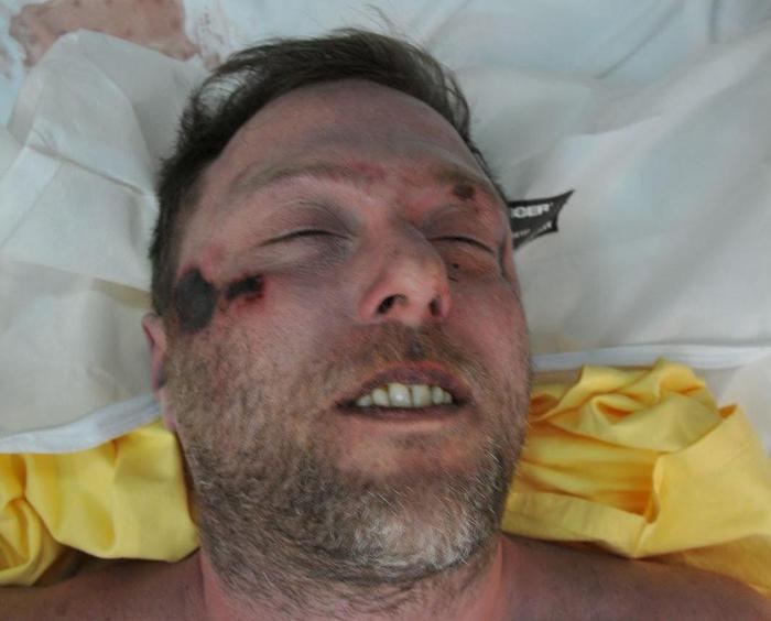 Riccardo Magherini, il padre Guido: “Venderò tutto per dare giustizia a mio figlio”