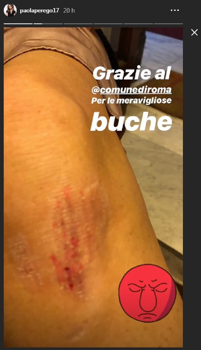 Paola Perego ginocchio