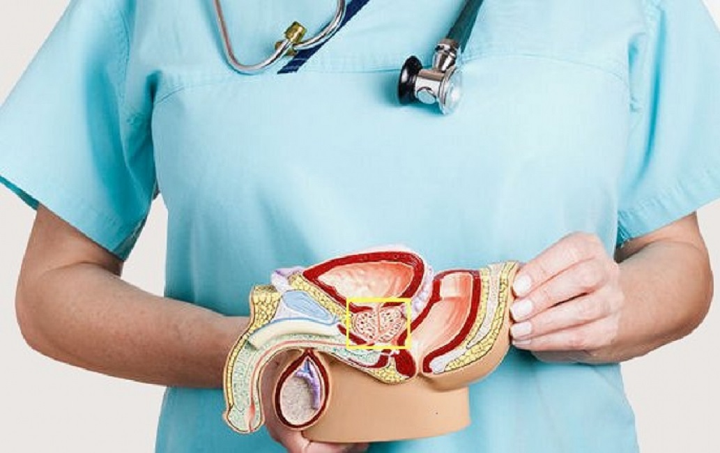 Prostata ingrossata? Un anello di metallo a forma di C può risolvere problemi urinari