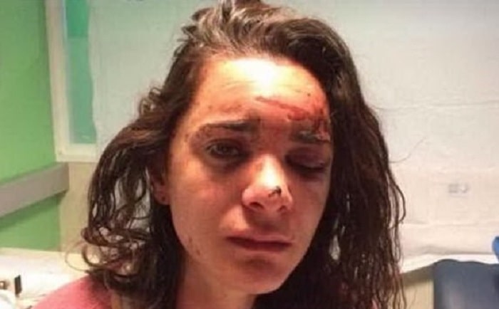 Andrea Sicignano, e la FOTO choc: si è finta morta per salvarsi dal suo aggressore