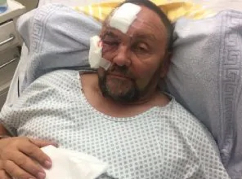 Frank Magnitz, il deputato di estrema destra è stato spinto ma non pestato e bastonato