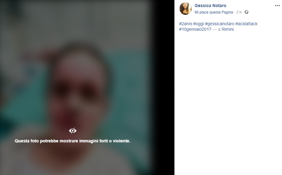 Gessica Notaro aggressione acido