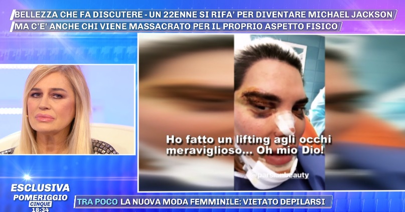 Pomeriggio 5, il Ken Umano mostra i nuovi occhi da gatto