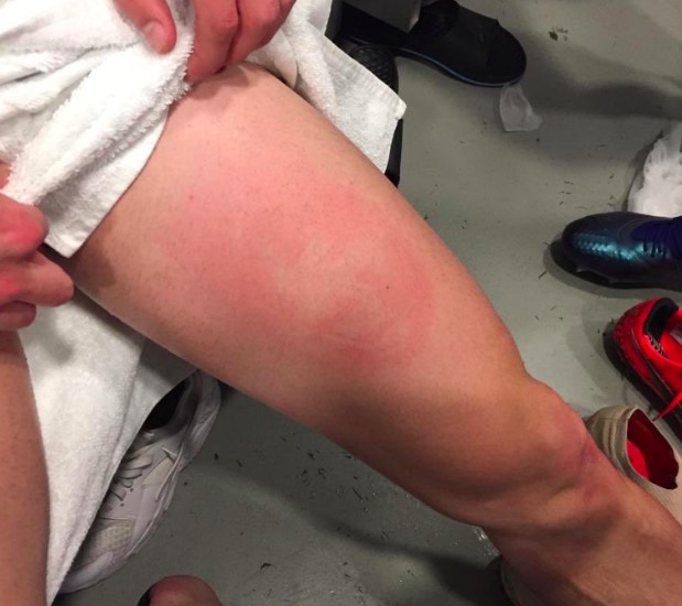 Milan-Napoli, espulsione Fabian Ruiz. Tweet polemico del Napoli: "Questo è il fallo di mano..."