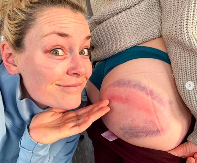 Lindsey Vonn si cala i pantaloni in diretta Instagram, lato b in bella mostra