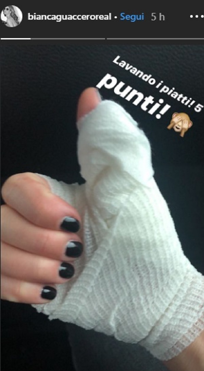 Detto Fatto, Bianca Guaccero in onda con la mano fasciata: cosa le è successo