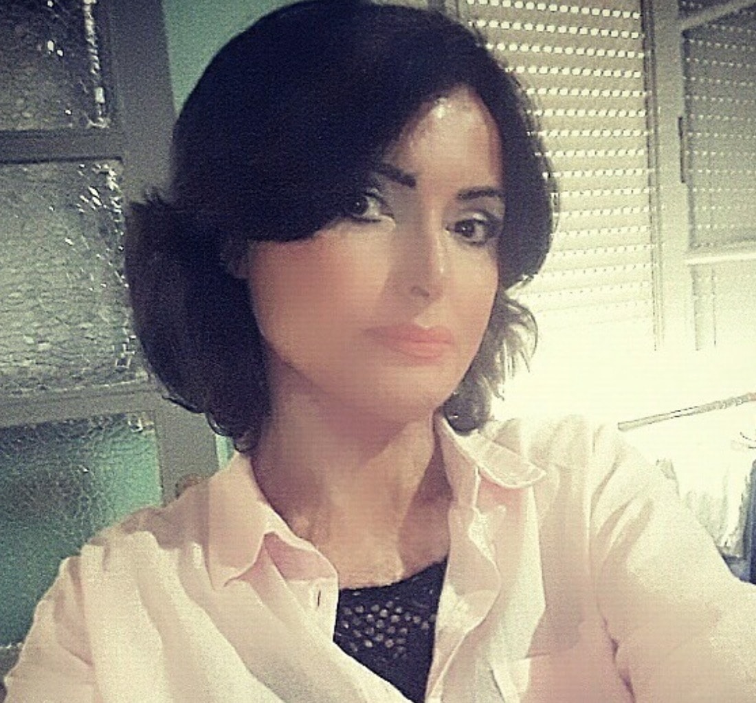 Carla Caiazzo, bruciata dall'ex: "Non odio gli uomini. Ma i violenti non cambiano"