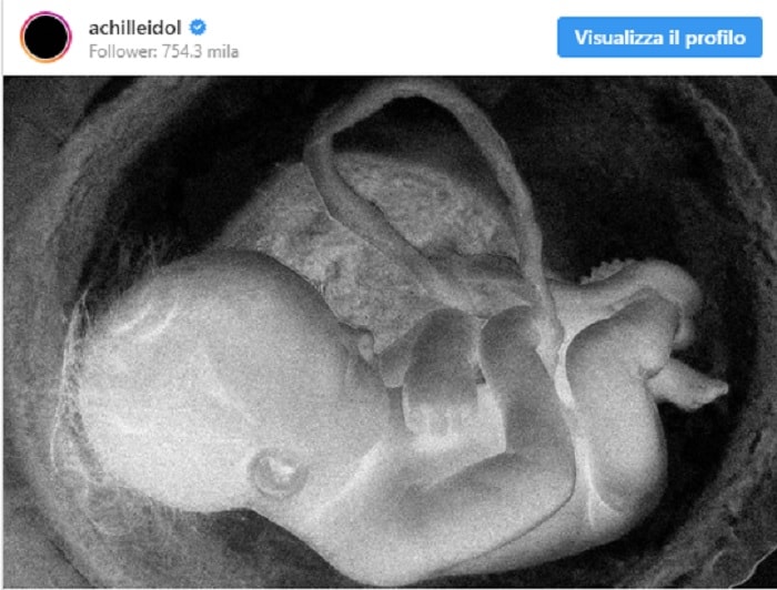 achille lauro foto feto