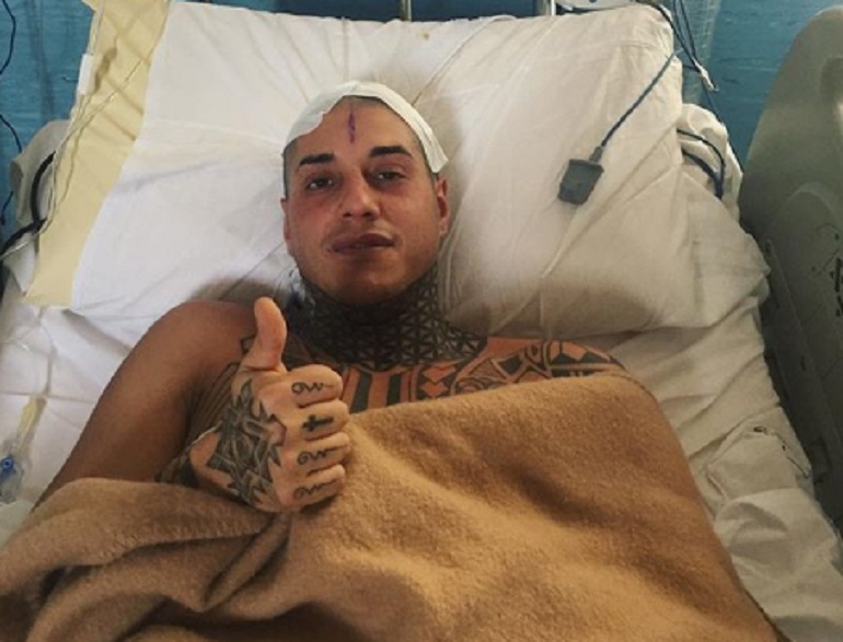 Francesco Chiofalo: "Dopo l'operazione ho perso 25 chili" (foto Instagram)