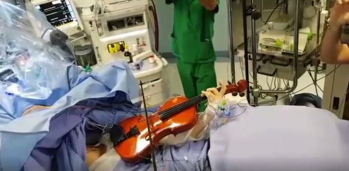 Taranto, operata di tumore al cervello mentre suona il violino