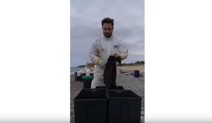 capodoglio plastica stomaco