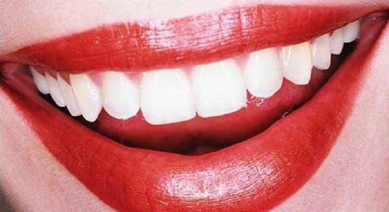 I dentifrici neri al carbone attivo non sbiancano i denti e... provocano la carie (foto Ansa)