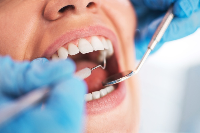 dentista sterilizzare ferri