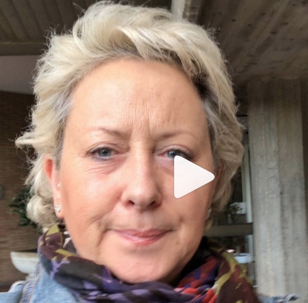 Ballando con le stelle, Carolyn Smith ha una trombosi al braccio destro