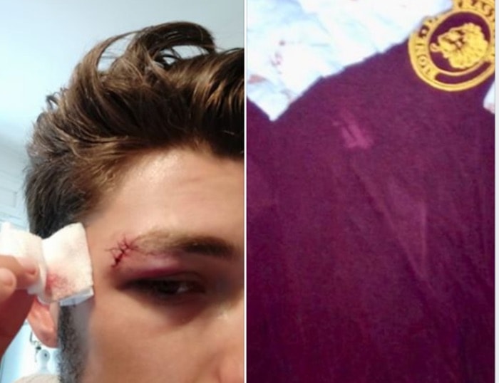 cinema america: l'aggressione durante un addio al celibato. il futuro sposo ha tirato il cazzotto