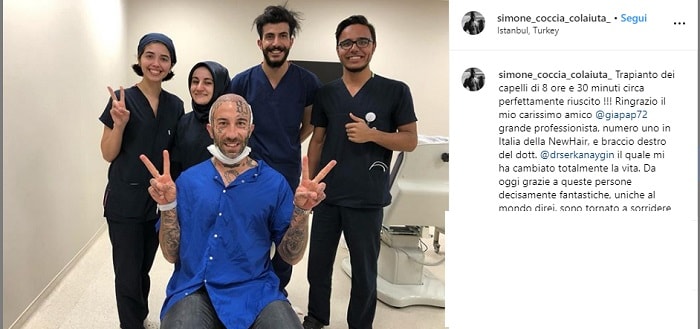 Simone Coccia Colaiuta, trapianto di capelli in Turchia FOTO: "Intervento lungo 8 ore perfettamente riuscito"3