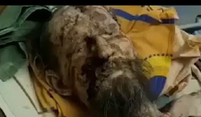 Russia, uomo sopravvive un mese prigioniero nella tana dell'orso: parti del corpo in decomposizione