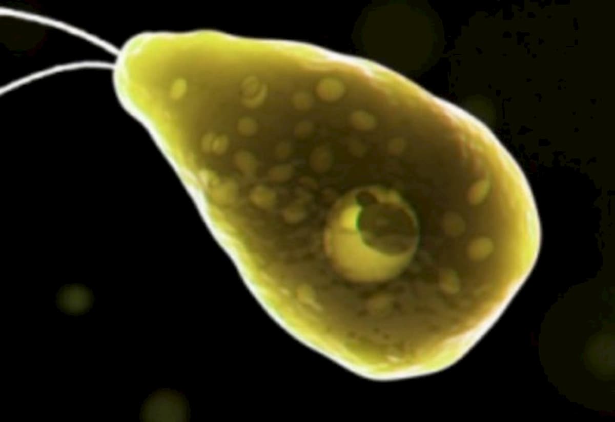 ameba mangia cervello