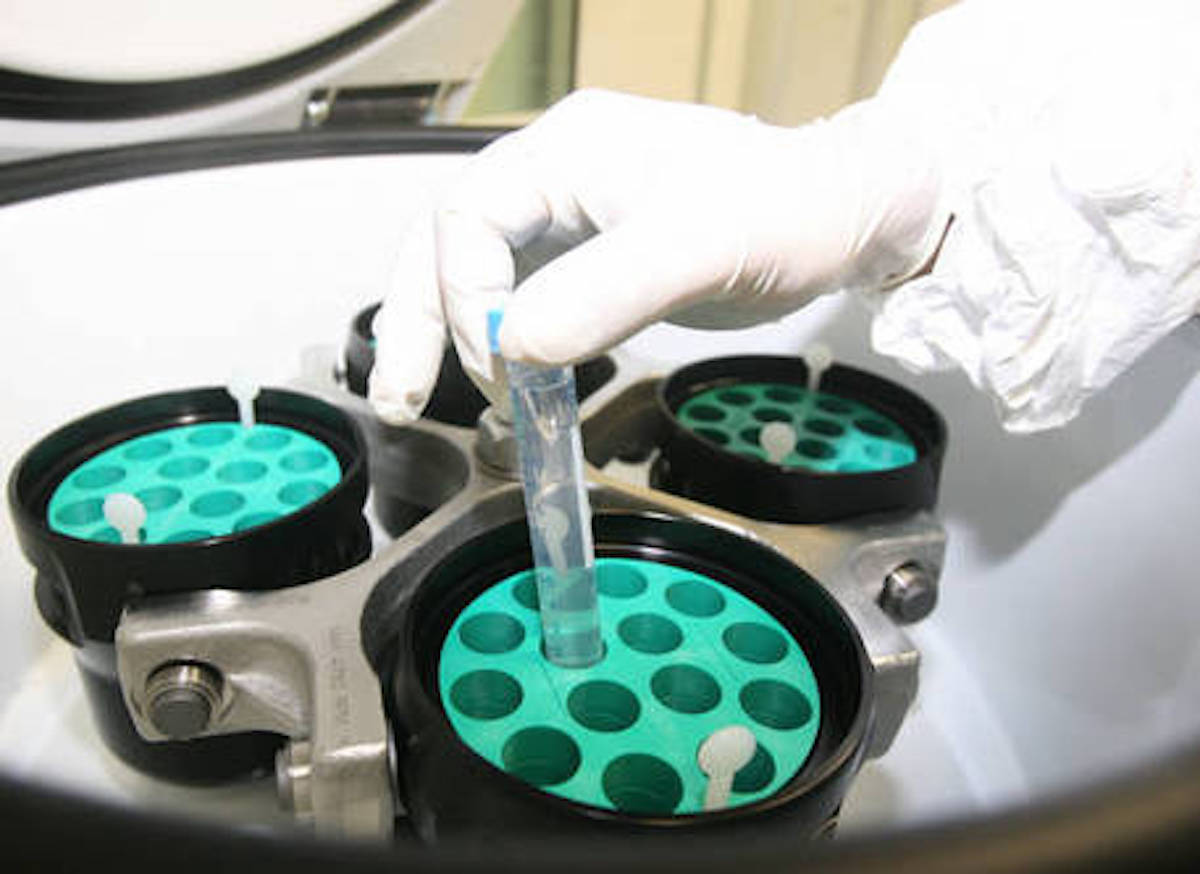 Scoperta nella lotta al cancro alla cervice uterina