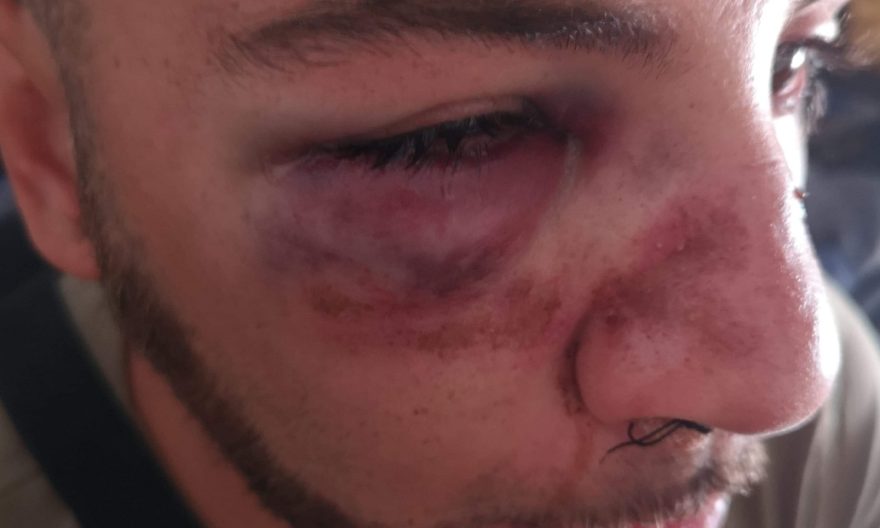 Etnaland, pestato dal branco che aveva rubato le ciabatte del figlio. La denuncia su Facebook