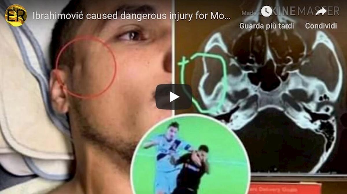 Ibrahimovic gomitata El Monir video youtube