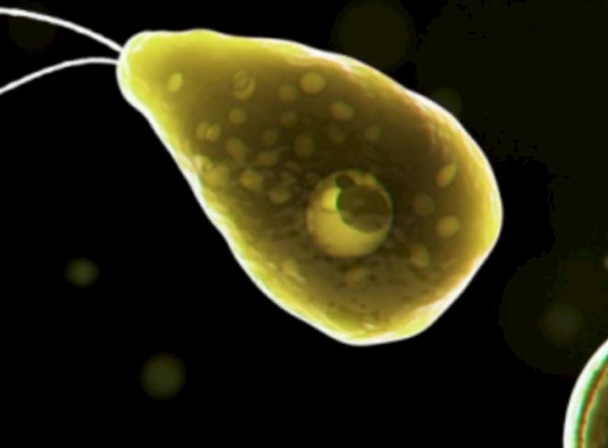 Ameba mangia cervello