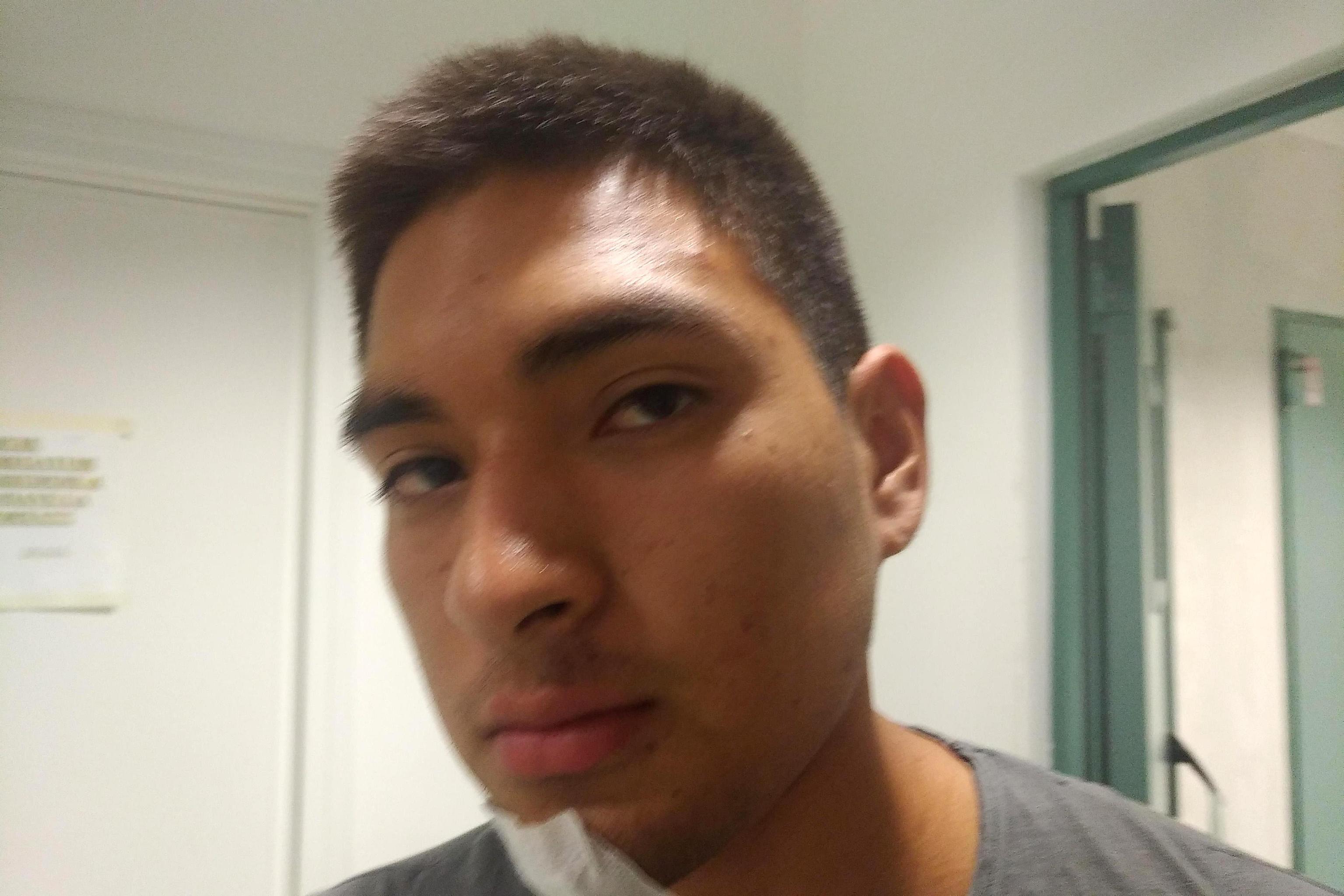 Casalmaiocco bimbo caduto angel salva