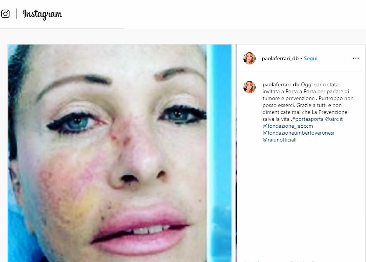 paola ferrari carcinoma