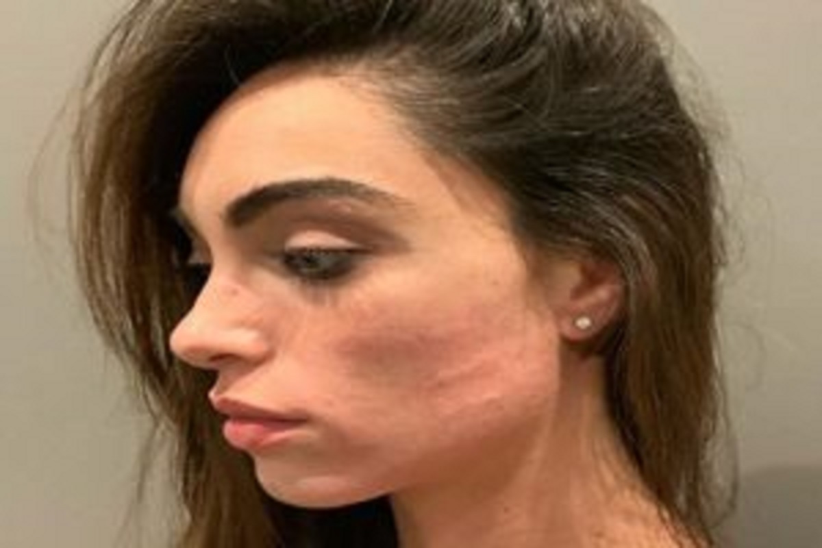 Verissimo, Lorella Boccia racconta l'aggressione: "Mi hanno schiaffeggiato..."