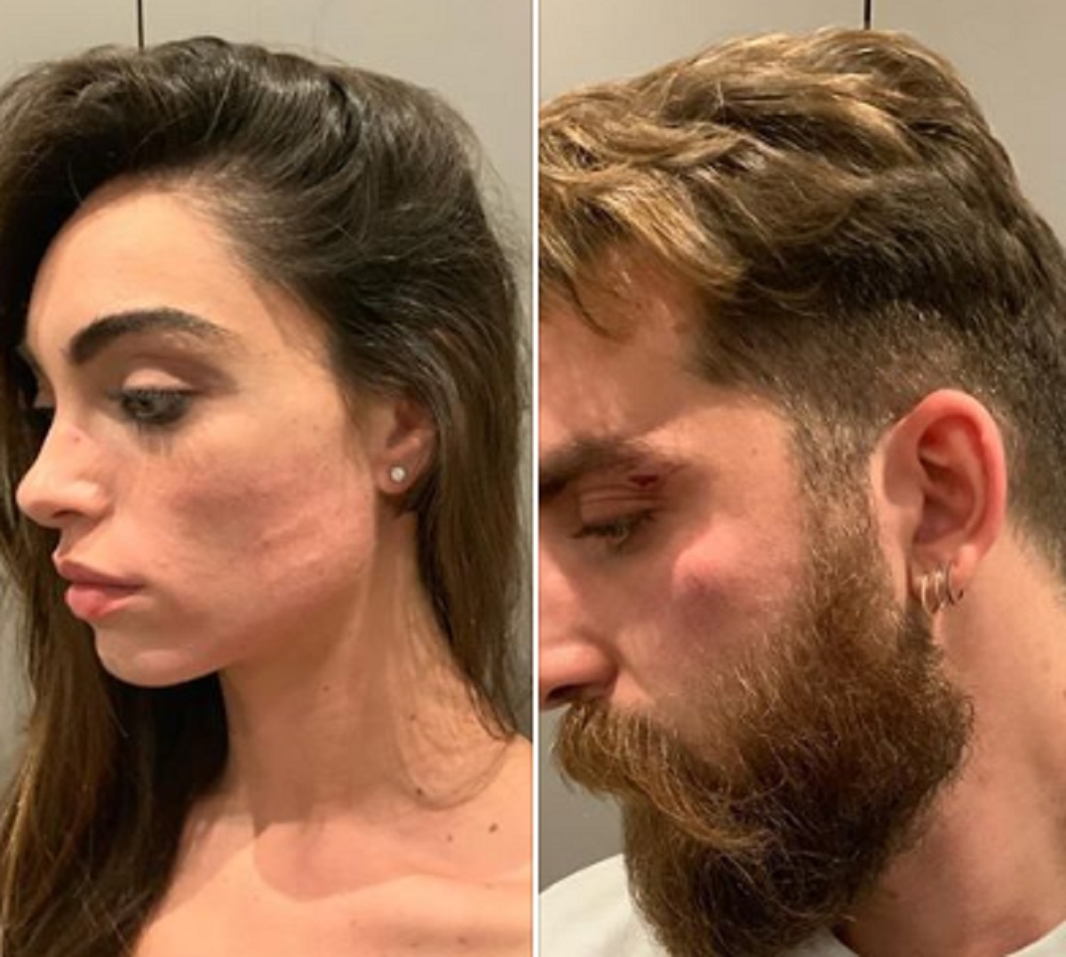 Lorella Boccia, la ballerina di Amici e il marito minacciati con un coltello, derubati e aggrediti