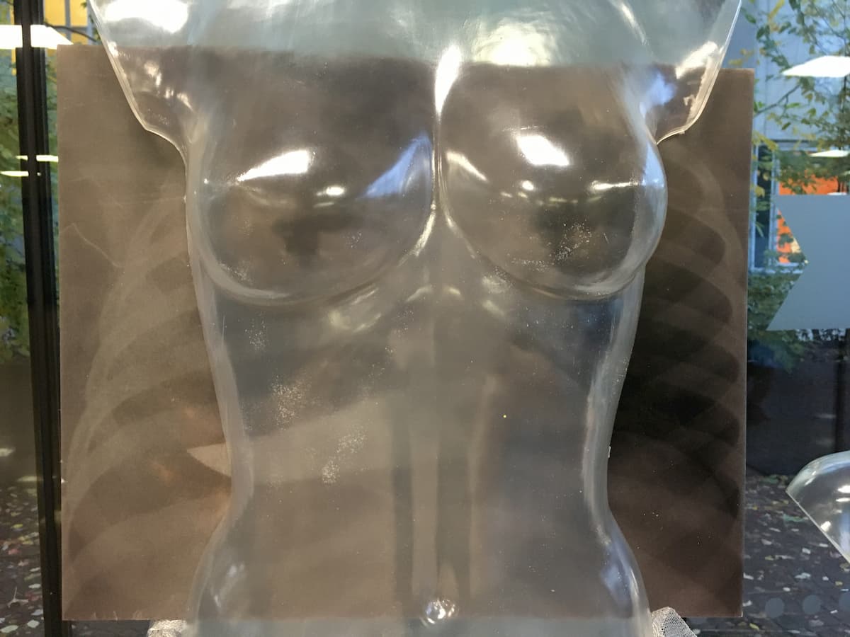 Violenza sulle donne: "Mi ha dato solo una coltellatina... Ma lui mi ama". Il racconto dei medici che assistono le vittime